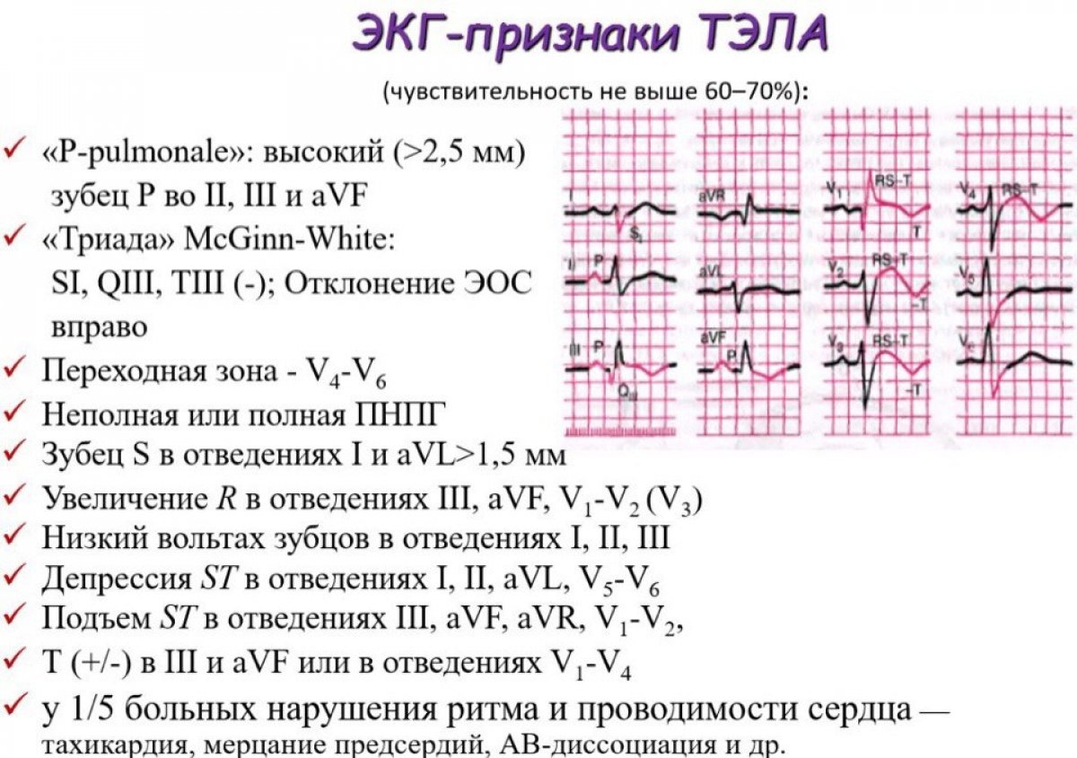 Новость от 26-05-2018