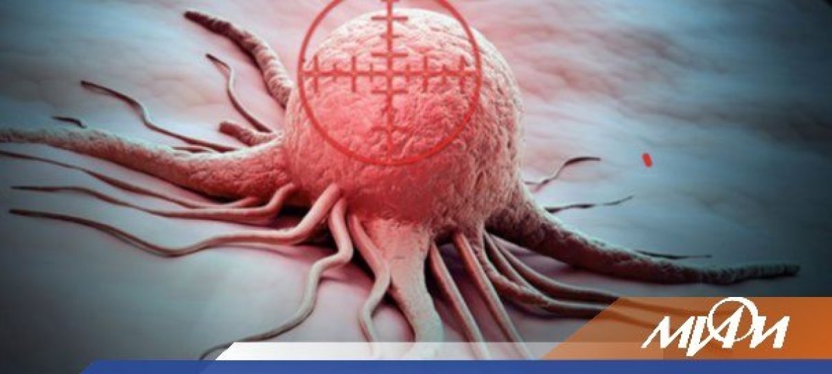 Ученые НИЯУ МИФИ приняли участие в разработке «магической пули», которая будет использоваться для направленной доставки лекарственных средств к раковой опухоли