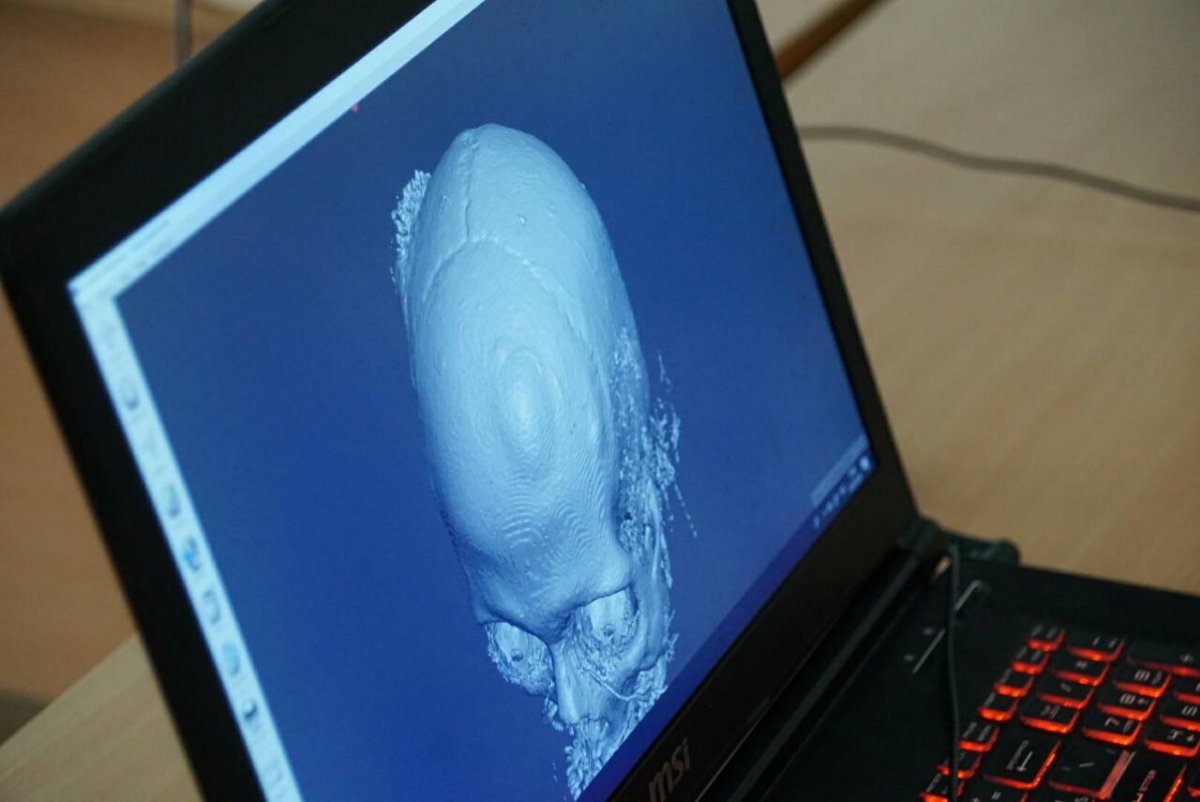 Сегодня в Университетская клиника ПИМУ состоялась экскурсия для учащихся нижегородского лицея № 8.