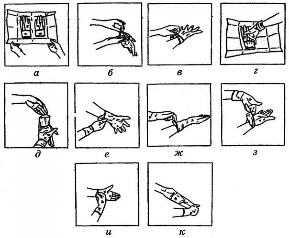 Схема одевания стерильных перчаток