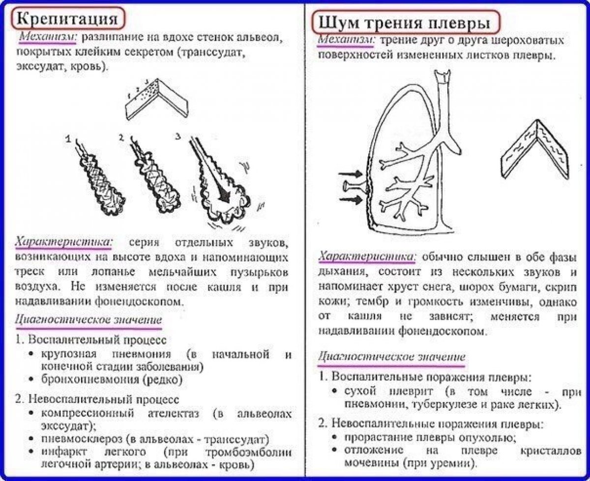 Аускультация