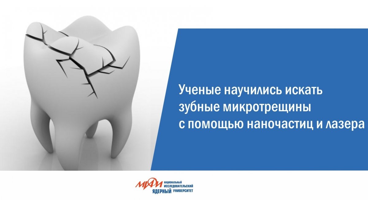 Учение НИЯУ МИФИ и Института общей физики имени А.М. Прохорова предложили метод обнаружения скрытых микротрещин и участков накопления патогенной микрофлоры с помощью лазера и наночастиц на поверхности зубной эмали.