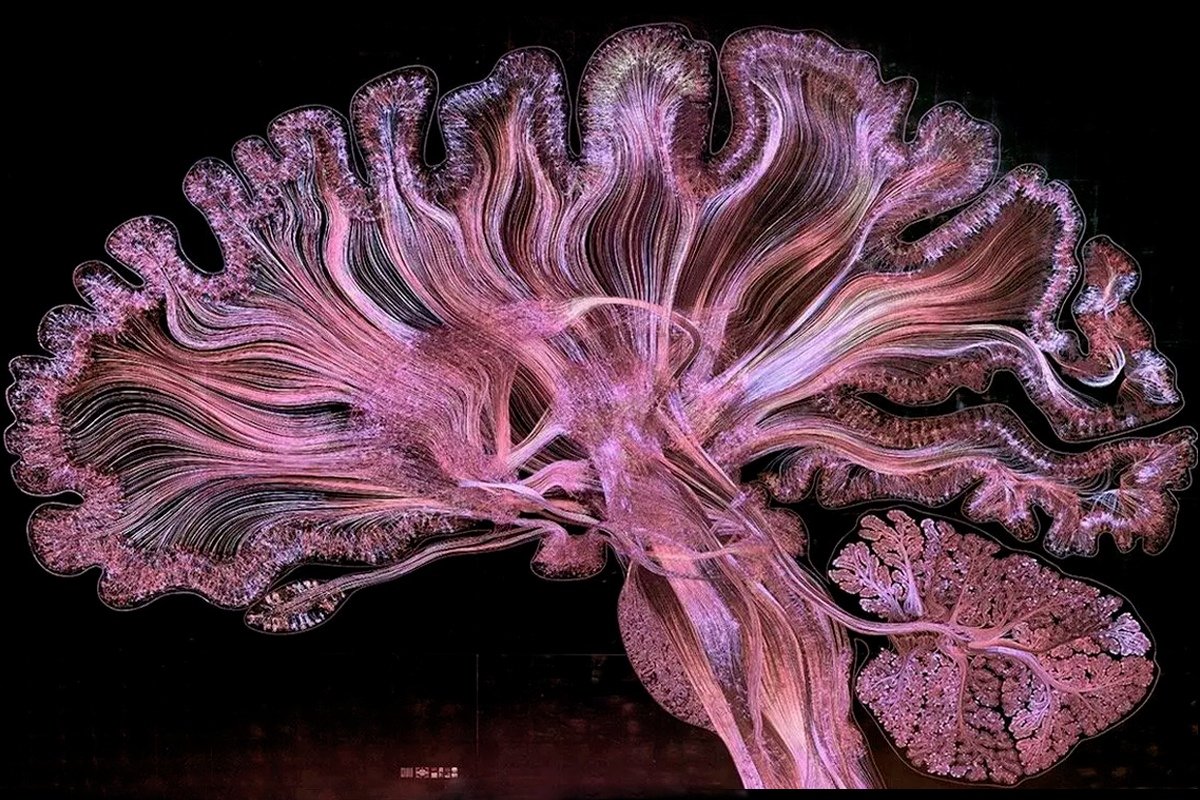 Влияют ли эмоции на мышление, что такое инсайтные задачи, и как измеряют активность мозга с помощью анаграмм? Влияют ли эмоции на мышление, что такое инсайтные задачи, и как измеряют активность мозга с помощью анаграмм?