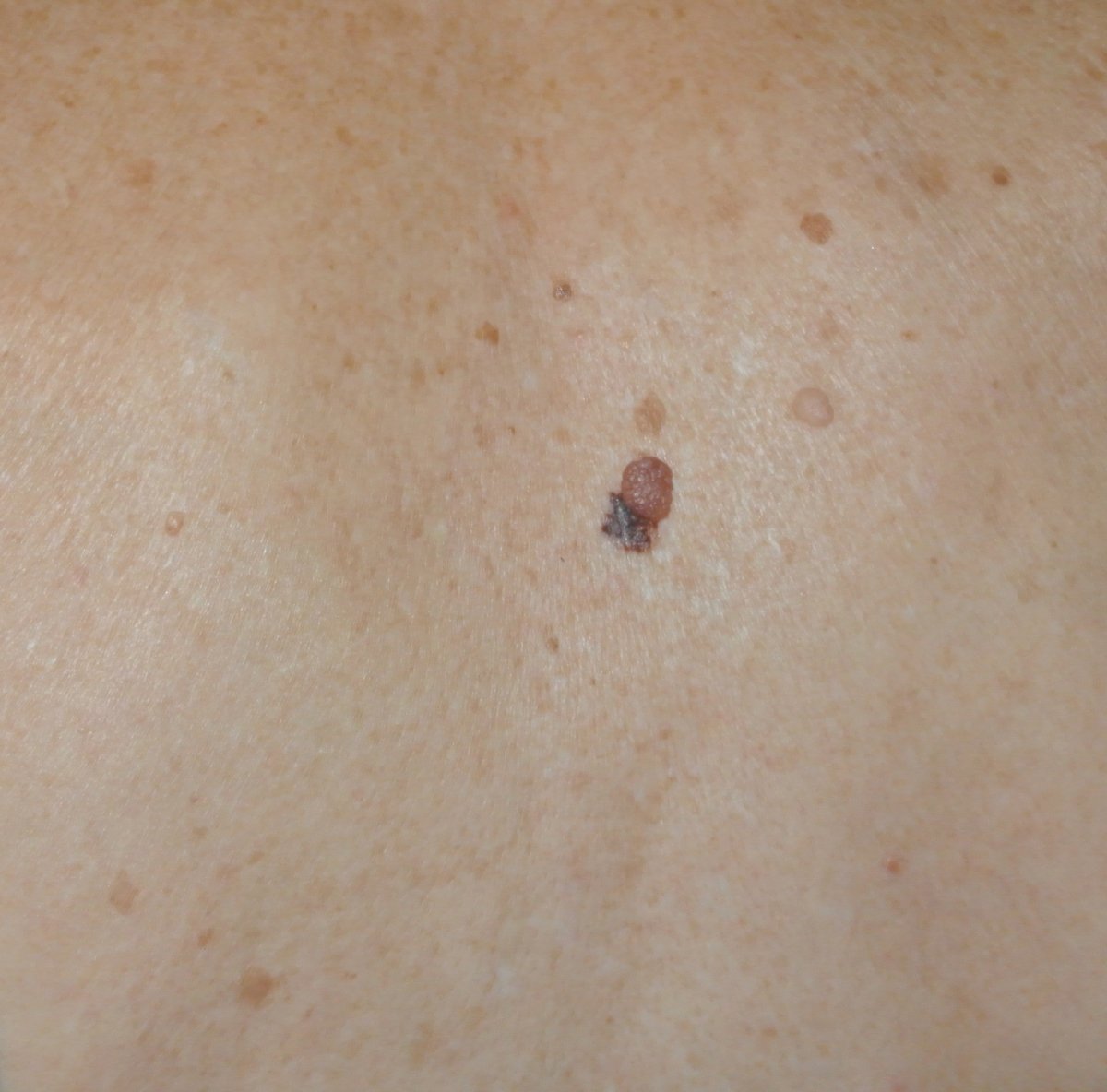 Клинический случай