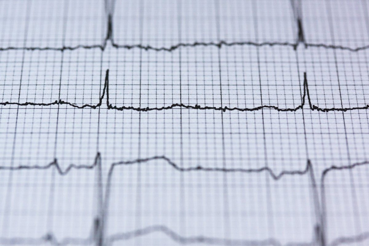 За прошедший год врачи Центра кардиохирургии и интервенционной кардиологии клиники имени Н. И. Пирогова выполнили 756 операций на открытом сердце: https://vk.cc/akQgDb За прошедший год врачи Центра кардиохирургии и интервенционной кардиологии клиники имени Н. И. Пирогова выполнили 756 операций на открытом сердце: https://vk.cc/akQgDb