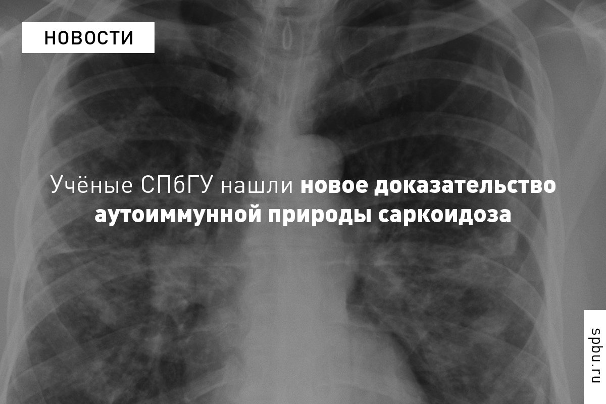 Исследователи впервые в мире изучили, как в организме больного лёгочным саркоидозом ведут себя фолликулярные Т-хелперы — особые клетки иммунитета, помогающие B-лимфоцитам производить антитела и нейтрализовать патогены: https://vk.cc/alZ04b