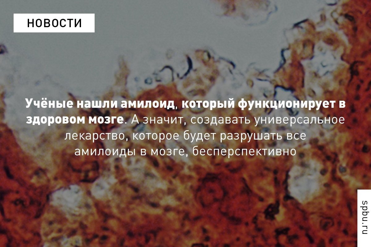 Учёные впервые обнаружили в здоровом мозге функциональный амилоид: https://vk.cc/amz8jO Учёные впервые обнаружили в здоровом мозге функциональный амилоид: https://vk.cc/amz8jO