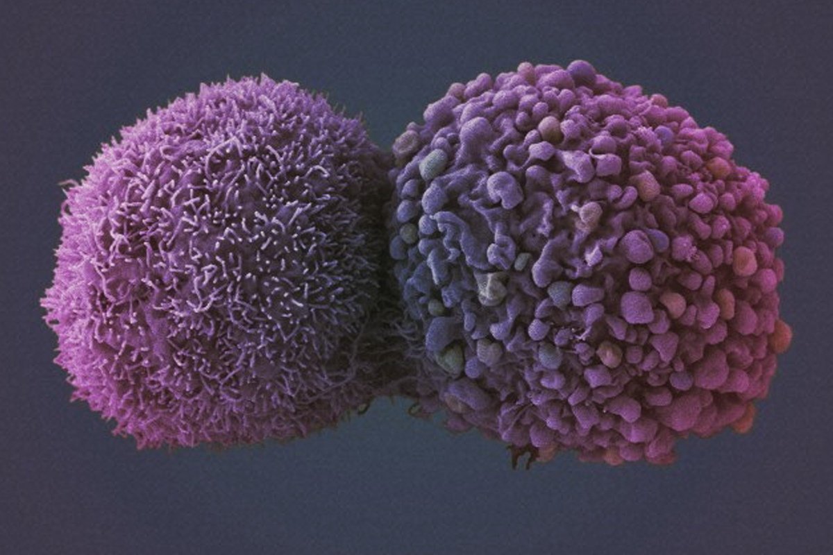 Число мутаций в клетках лёгких у бросивших курить падает почти вдвое