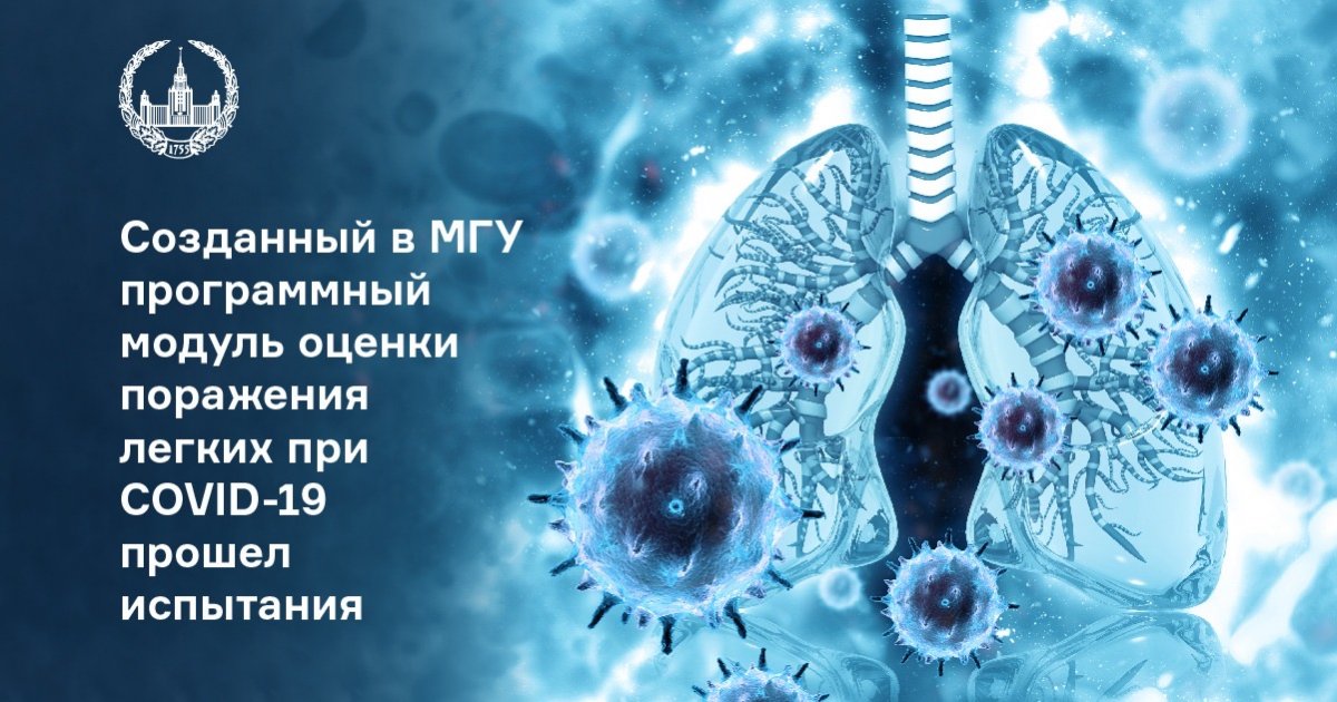 Созданный в МГУ программный модуль для оценки поражения легких при COVID-19 прошёл испытания