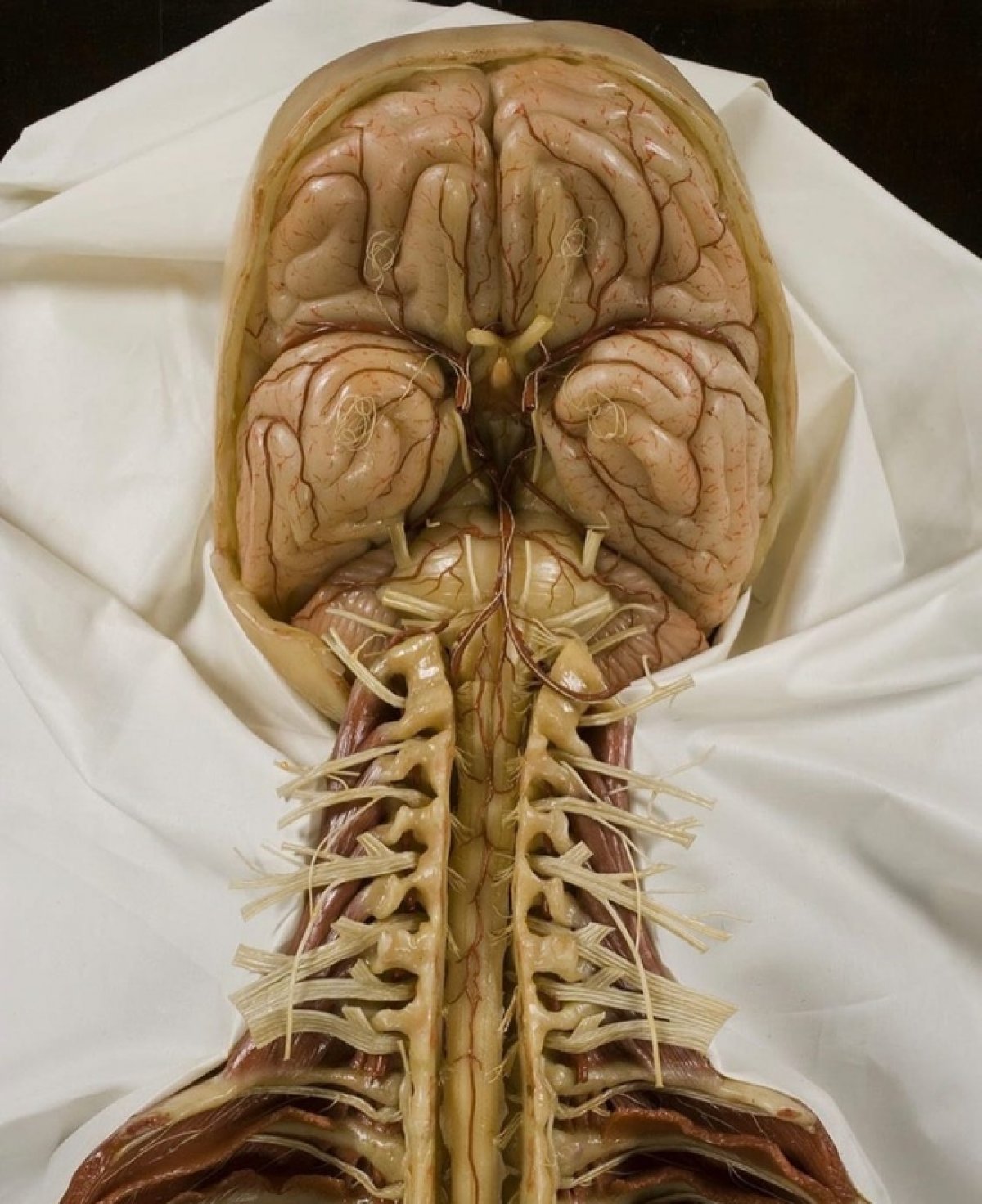 Центральная нервная система