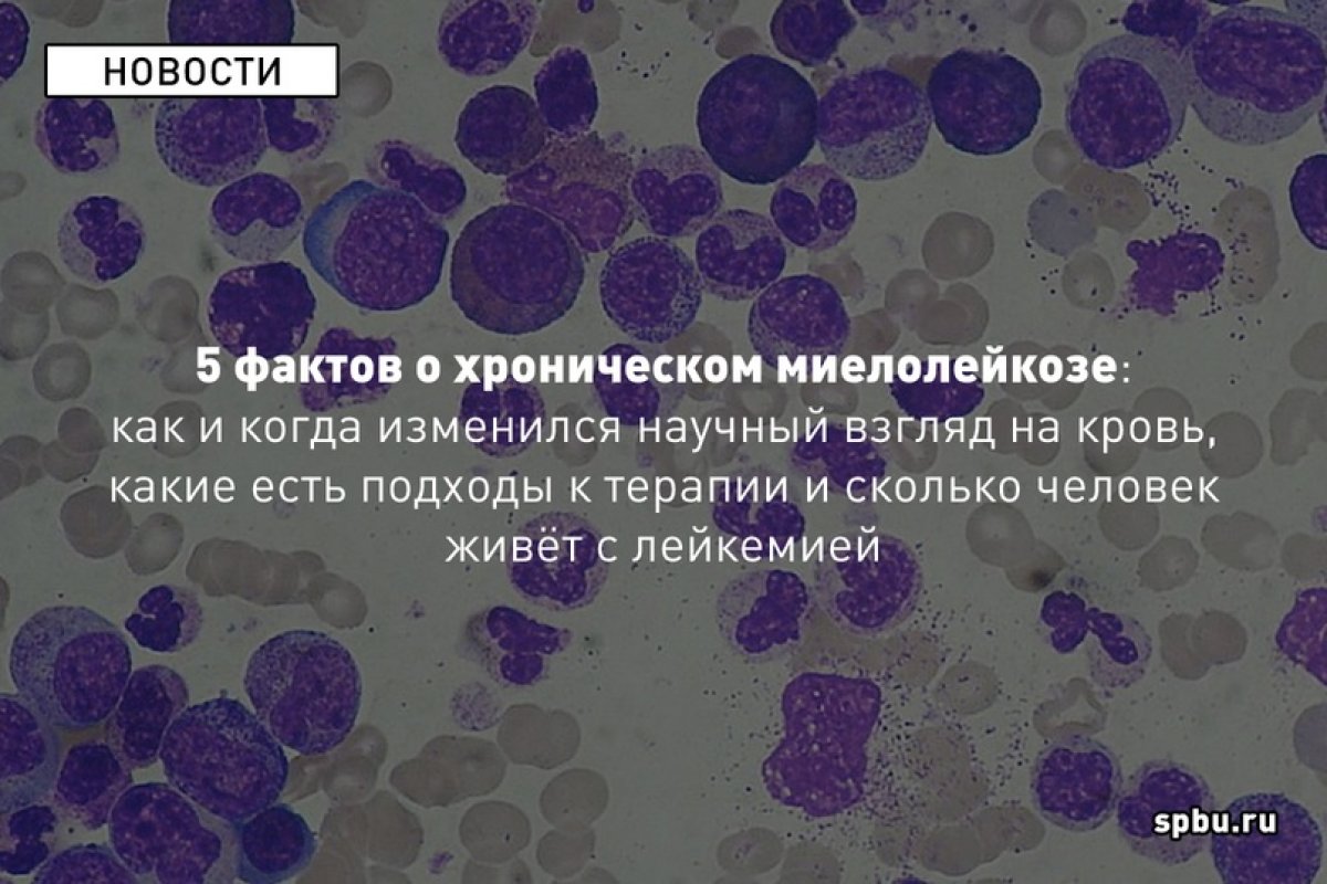 Ассистент кафедры госпитальной терапии СПбГУ, врач-онкогематолог Михаил Фоминых — о хроническом миелолейкозе: как и когда изменился научный взгляд на кровь, какие есть подходы к терапии и сколько человек живёт с лейкемией